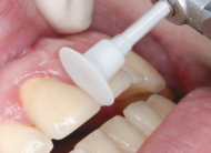 One Gloss Polishing System - Imagen 5