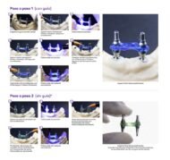 Hemospon Pattern Photo Gel - Imagen 3